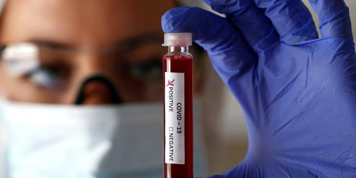 إطلاق أكبر تجربة بالعالم لكشف 50 نوعا من السرطان قبل ظهور الأعراض إطلاق أكبر تجربة بالعالم لكشف 50 نوعا من السرطان قبل ظهور الأعراض