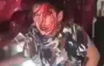 "بابا اقتلني".. صرخة طفل تهتز لها مواقع التواصل