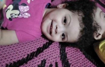 التوأم السيامي المصري "سلمى وسارة" يصل إلى الرياض.. لإجراء عملية فصلهما