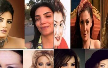 نجمات صرن ضحايا لعمليات التجميل.. تعرف على الأبرز!
