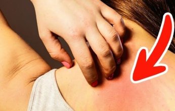 احذر هذه الاعراض المرضية الشائعة تنذر بالاصابة بالسرطان