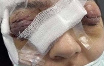 السعودية.. القبض على زوج لاعتداءه بالضرب بوحشية على زوجته