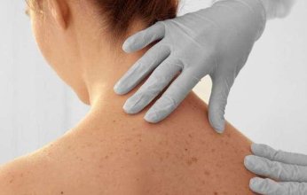 بريطانيا تسجل 43 حالة إصابة جديدة من جدري القرود