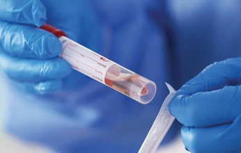 عالميًا.. استمرار تسجيل إصابات فيروس كورونا