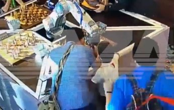 تفاصيل هجوم روبوت بشكل مفاجئ على طفل موهوب