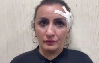 ضبط امرأة باعت رضيعها بـ 3600 دولار.. لإجراء عملية تجميل