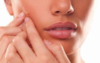 علاج حبوب البشرة