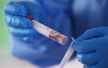 الصحة الكويتية: ضرورة إجراء الحجاج فحص PCR خلال 3 أيام من العودة