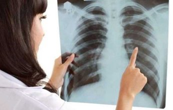 احترس: سرطان الرئة ليس مقتصراً على المدخنين