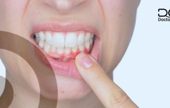 أعراض امراض اللثة وطرق العلاج