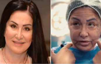 تفاصيل صادمة بشأن تشويه وجه الفنانة وفاء سالم بسبب عمليات التجميل