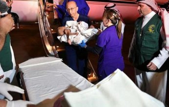 التوأم السيامي النيجيري "حسانة وحسينة" يصلان إلى السعودية