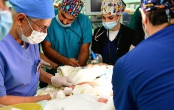 السعودية.. نجاح فصل توأم سيامي في عملية استغرقت 7 ساعات