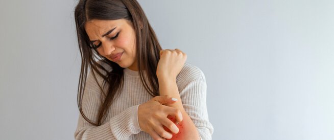 نصائح مهمة لتفادى حكة الجلد نصائح مهمة لتفادى حكة الجلد