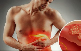 علماء يكشفون عن نهج جديد لعلاج سرطان الكبد