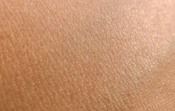 صناعة آلة من Lego يمكنها إنماء جلد الإنسان.. فما القصة؟