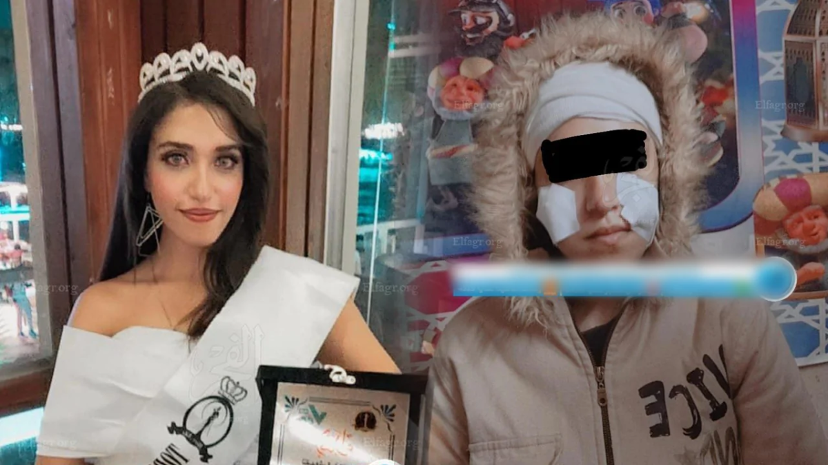 تفاصيل صادمة بشأن واقعة تشويه وجه ملكة جمال النيل مروة عادل تفاصيل صادمة بشأن واقعة تشويه وجه ملكة جمال النيل مروة عادل