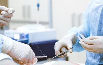 باحثون ينجحون في تطوير خيوط جراحية «ذكية» تشعر بالالتهاب وتعالجه
