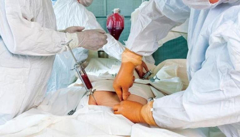 دراسة جديدة.. أجنحة الحشرات ترمم عظام البشر دراسة جديدة.. أجنحة الحشرات ترمم عظام البشر