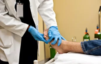 علامة في أصابع القدمين تشير إلى ارتفاع الكوليسترول