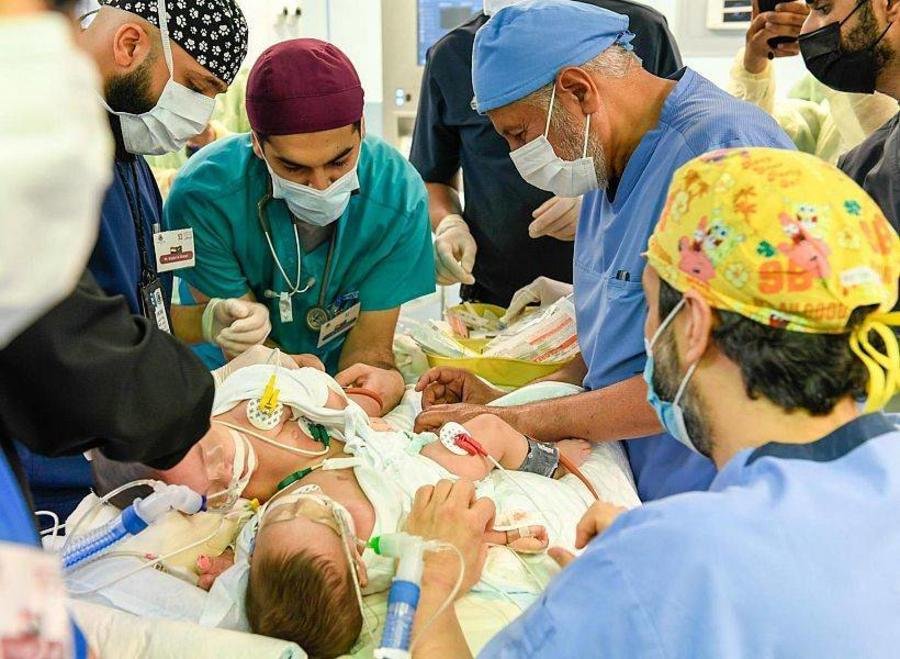 بدء عملية فصل التوأم السيامي النيجيري بمشاركة 35 كادر طبي متخصص بدء عملية فصل التوأم السيامي النيجيري بمشاركة 35 كادر طبي متخصص