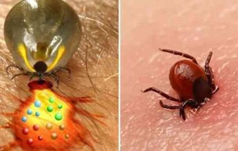 بالتفاصيل.. كل ما تريد معرفته عن فيروس «أوز» القاتل