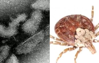 الإعلان عن أول وفاة في العالم بفيروس «أوز».. فما القصة؟