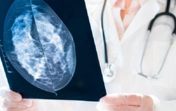 اكتشاف مركب حيوي يوقف انتشار سرطان الثدي في الجسم