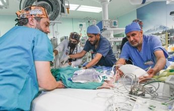 السعودية.. نجاح فصل التوأم السيامي السوري "إحسان وبسام"