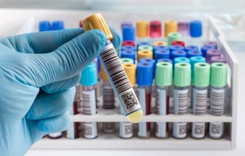 علماء روس يبتكرون طريقة جديدة لعلاج الأورام الخبيثة