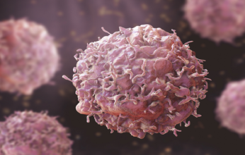 اكتشاف جديد قد يخلّص مرضى السرطان في مراحل متأخرة من تطور الورم.. التفاصيل