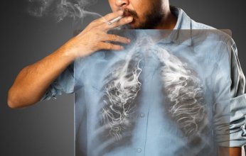 هل يعد التدخين سبب رئيسي للانسداد الرئوي؟.. دراسة تجيب