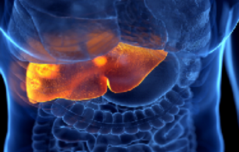 بالتفاصيل.. طرق مكافحة التهابات الكبد الفيروسية B و C