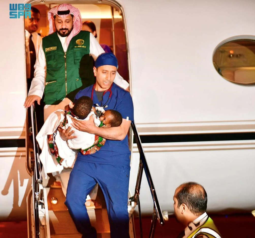وصول التوأم السيامي التنزاني "حسن وحسين" إلى الرياض وصول التوأم السيامي التنزاني "حسن وحسين" إلى الرياض