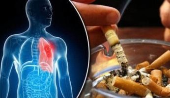هل يتسبب التدخين فى ارتفاع ضغط الدم.. وكيف؟