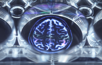 دراسة حديثه تكشف مفتاح صحة الدماغ في الشيخوخة