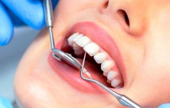 القبض على 21 شخصاً يمارسون طب الأسنان بلا شهادة بالأردن