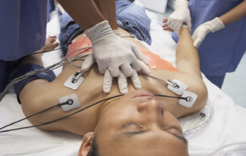 دراسة حديثه تكشف ما يحدث لأدمغة المرضى بعد توقف عمل القلب