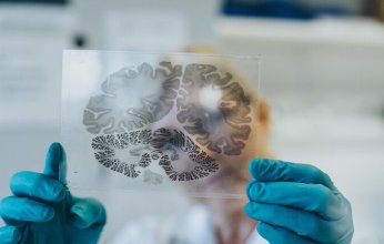 اكتشاف سببًا جديدًا محتملًا لمرض ألزهايمر.. إعرف التفاصيل