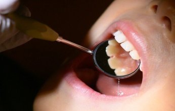 ما هي العادات السيئة المدمرة للأسنان؟.. طبيبة تجيب