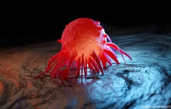 دراسة حديثه.. المكملات الغذائية مضرة لمرضى السرطان