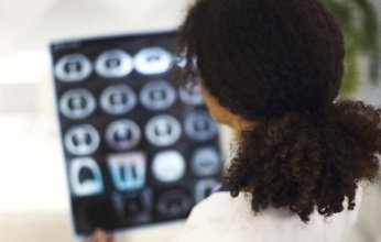 دراسة تكشف أسباب ارتفاع إصابات السرطان لدى الشباب بنسبة 80%