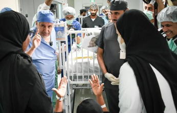 نجاح عملية فصل التوأم السيامي التنزاني "حسن وحسين" بعد جراحة معقدة استغرقت 16 ساعة