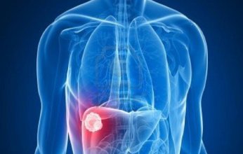 دراسة بريطانية تكشف الصلة بين الاضطرابات الشخصية وأمراض الكبد الدهني