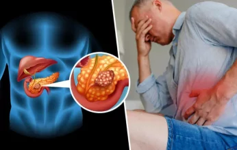 دراسة حديثه.. اصفرار لون الجلد يتنبأ بخطر الإصابة بسرطان البنكرياس