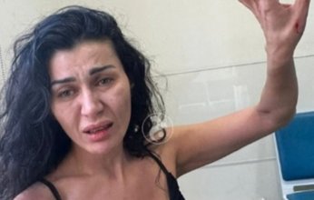 نادين الراسي تواجه تحدٍ جديد في حياتها بعد اعتداء شقيقها