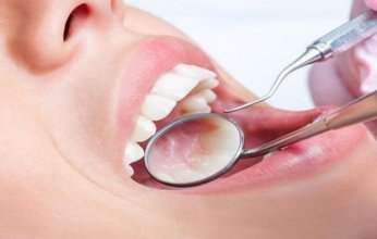 تعرف إلى أعراض وطرق الوقاية من سرطان تجويف الفم