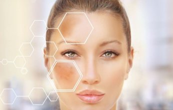 أسباب تصبغات البشرة وطرق علاجها