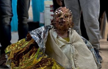 انقذوا سجى.. قصة طفلة فلسطينية أحرق الاحتلال وجهها