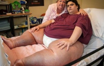 وفاة أسمن رجل في العالم.. وزنه اقترب من 400 كيلو غرام